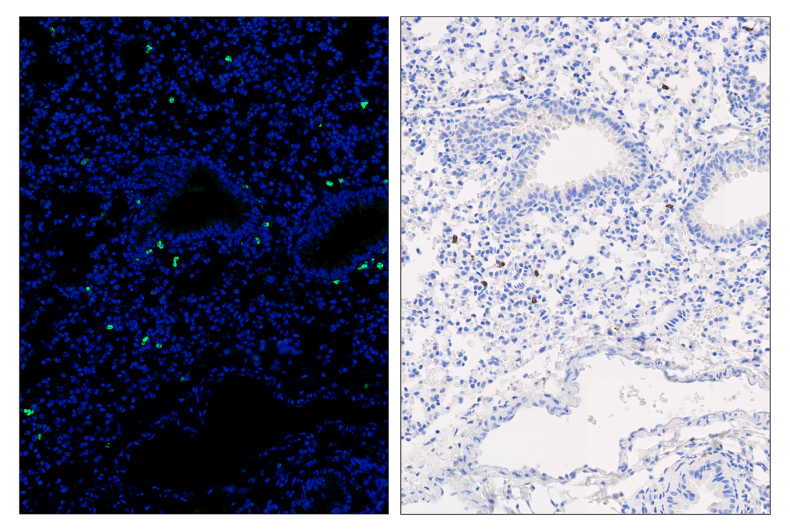 Immunohistochemistry Image 6: CD8α (D4W2Z) & CO-0040-647 SignalStar<sup>™</sup> Oligo-Antibody Pair