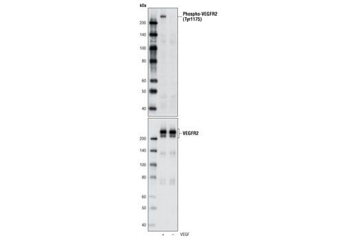 undefined Image 2: Phospho-VEGF Receptor 2 Antibody Sampler Kit