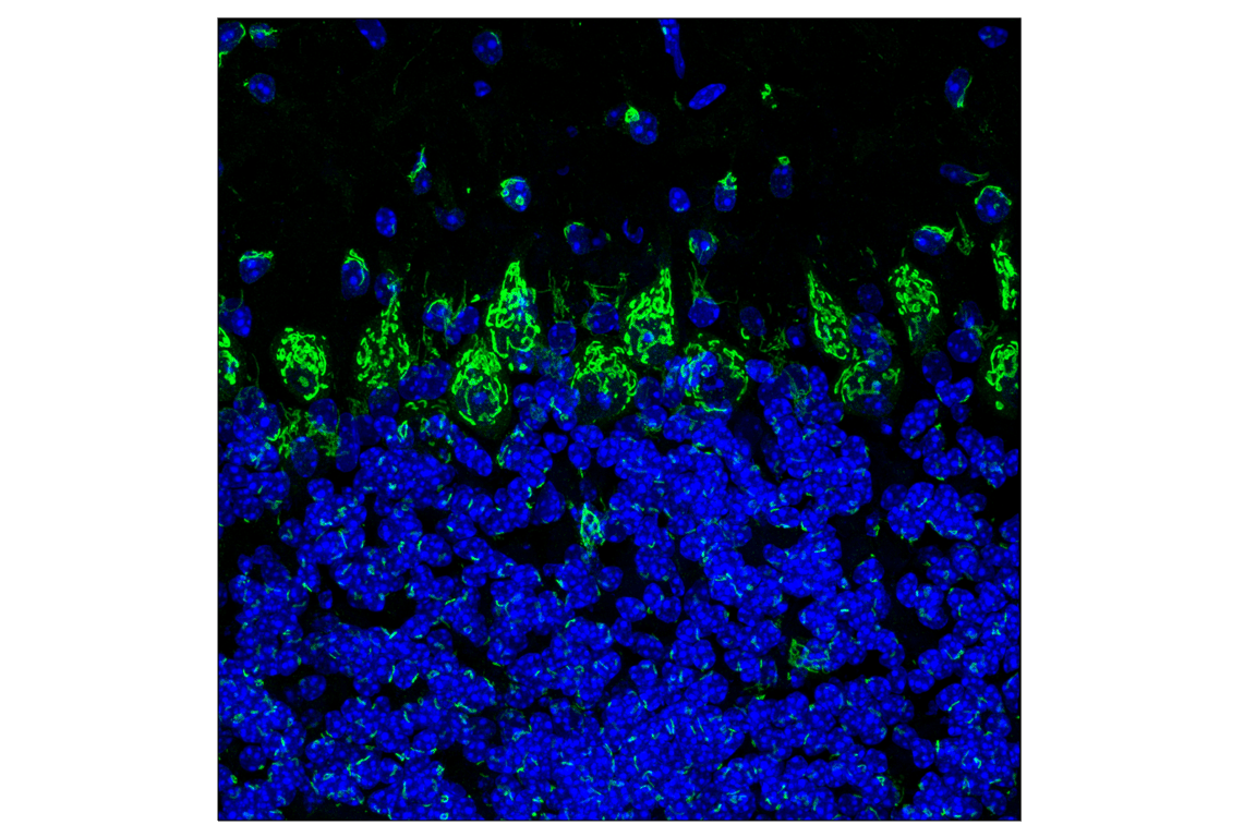 Immunofluorescence Image 1: RCAS1 (D2B6N) Rabbit Monoclonal Antibody (BSA and Azide Free)