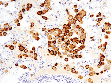 Immunohistochemical analysis of paraffin-embedded  spleen using FoxP3 (D6O8R) Rabbit mAb