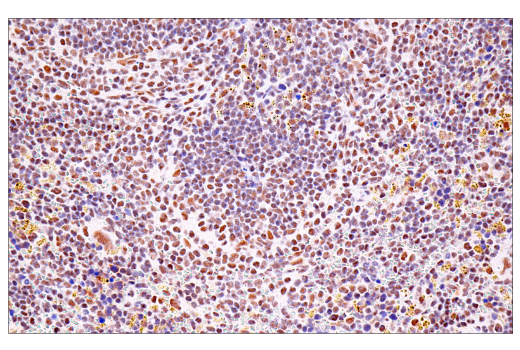 Immunohistochemistry Image 14: USP39 (E8U2M) Rabbit Monoclonal Antibody