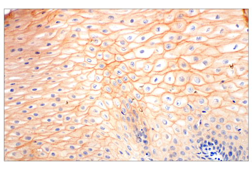 Immunohistochemistry Image 3: EphA2 (D4A2) Rabbit Monoclonal Antibody (BSA and Azide Free)