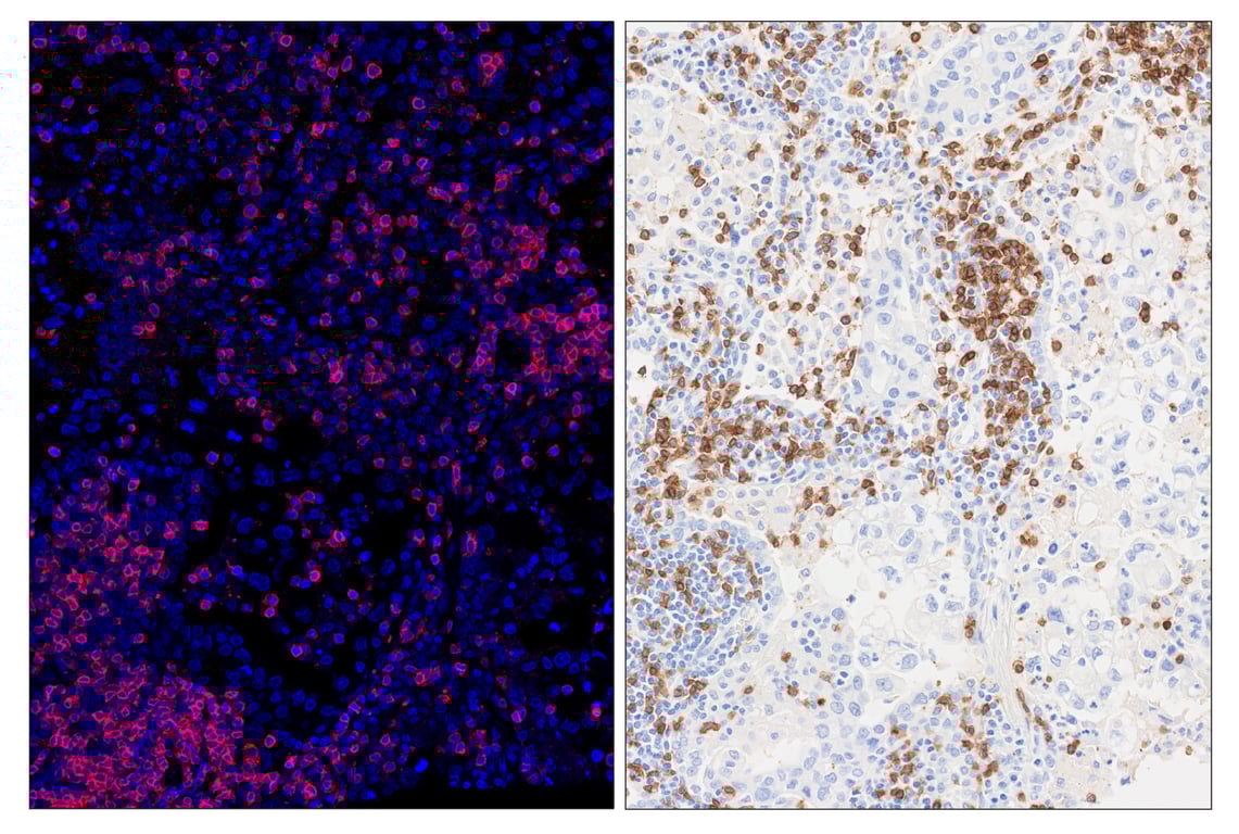 Immunohistochemistry Image 6: CD3 epsilon (D7A6E<sup>™</sup>) & CO-0001-750 SignalStar<sup>™</sup> Oligo-Antibody Pair