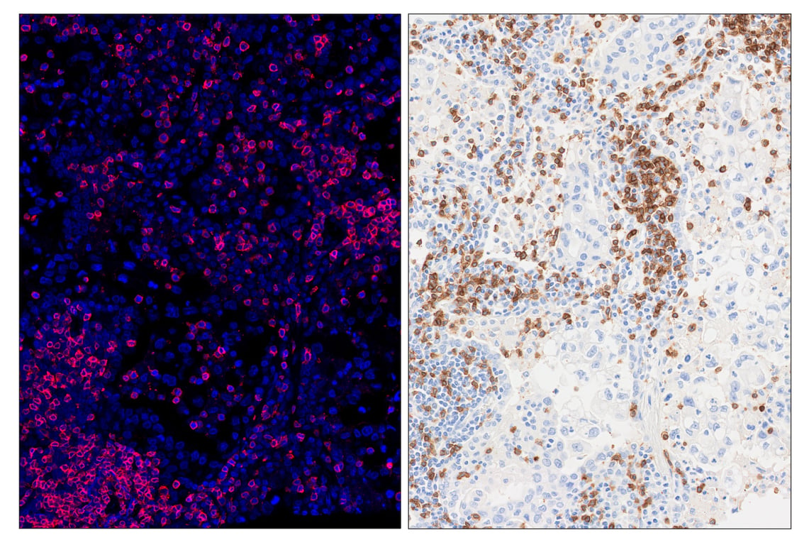 Immunohistochemistry Image 6: CD3ε (D7A6E<sup>™</sup>) & CO-0001-647 SignalStar<sup>™</sup> Oligo-Antibody Pair