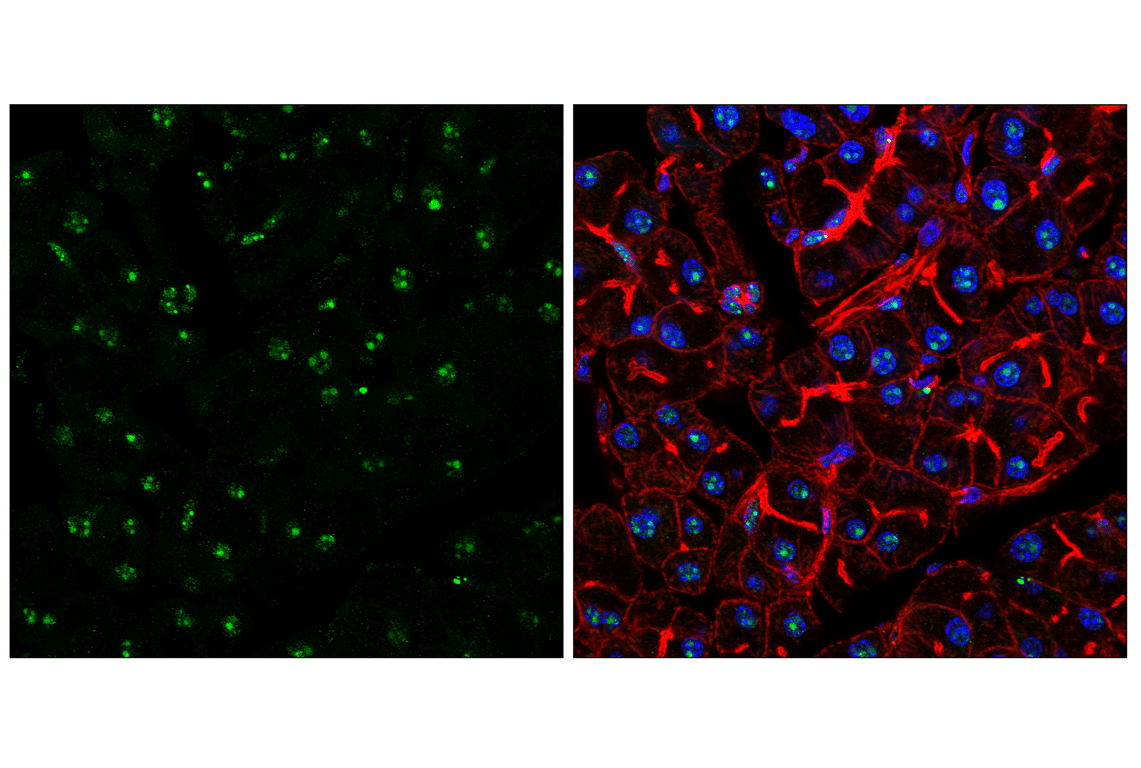 Immunofluorescence Image 1: NPM1 (E7W4P) Rabbit mAb (BSA and Azide Free)
