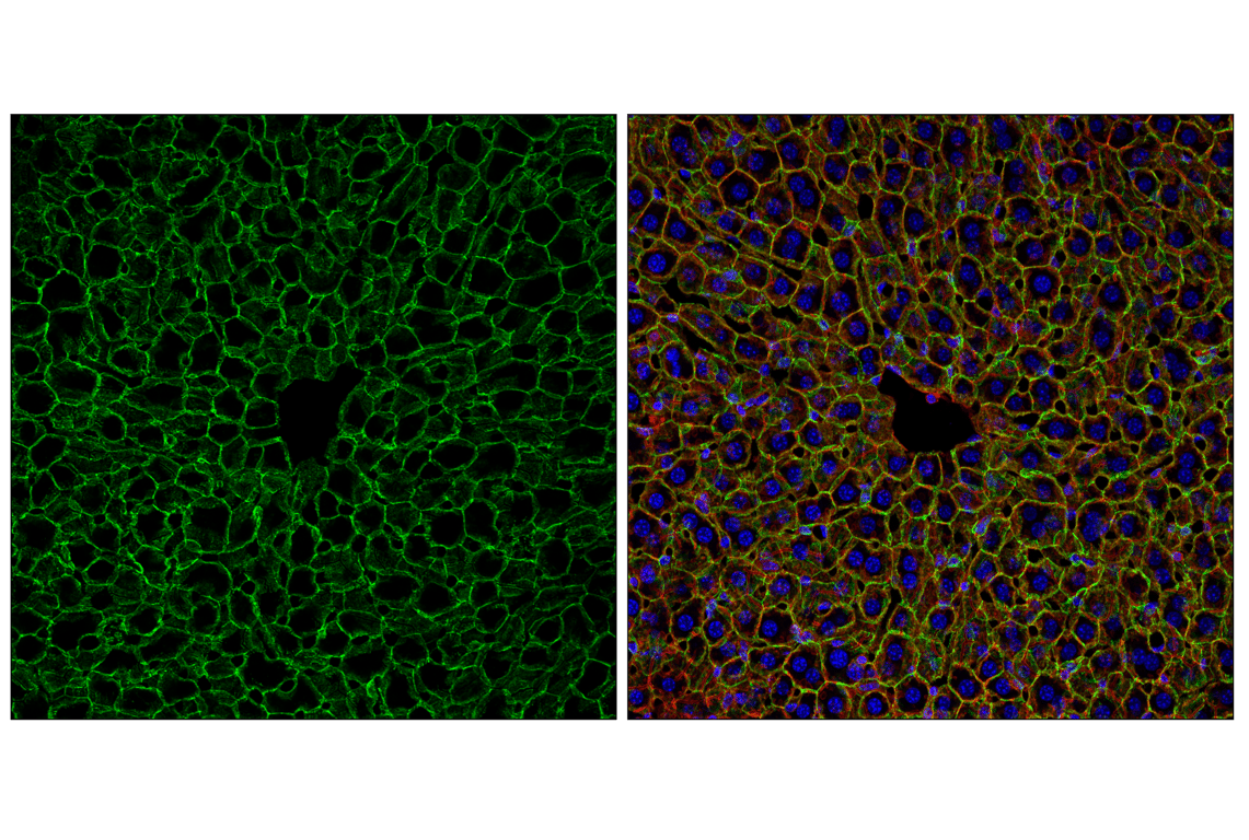 undefined Image 76: Epithelial-Mesenchymal Transition (EMT) Antibody Sampler Kit