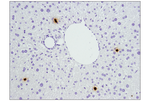 Immunohistochemistry Image 7: S100A9 (D3U8M) Rabbit Monoclonal Antibody