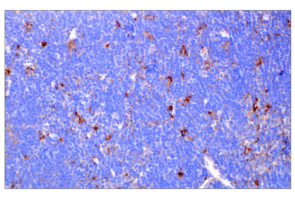 undefined Image 40: Genetics of Parkinson's Disease: Lysosomal Dysfunction Antibody Sampler Kit
