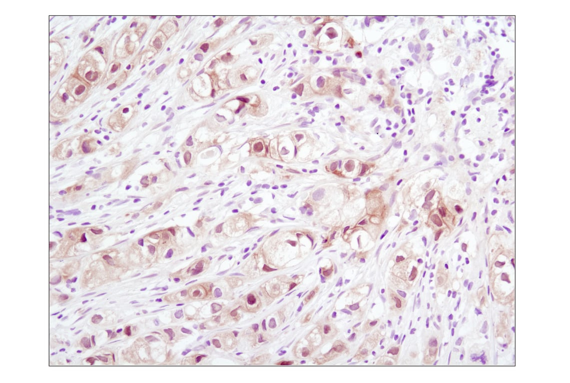 Immunohistochemistry Image 2: Phospho-Akt (Ser473) (D9E) XP<sup>®</sup> Rabbit mAb (BSA and Azide Free)