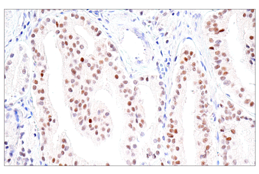 Immunohistochemistry Image 1: PMS2 (M0R4G) Mouse Monoclonal Antibody
