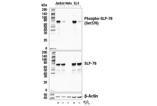 Western Blotting Image 2: Phospho-SLP-76 (Ser376) (E3G9U) Rabbit Monoclonal Antibody (BSA and Azide Free)
