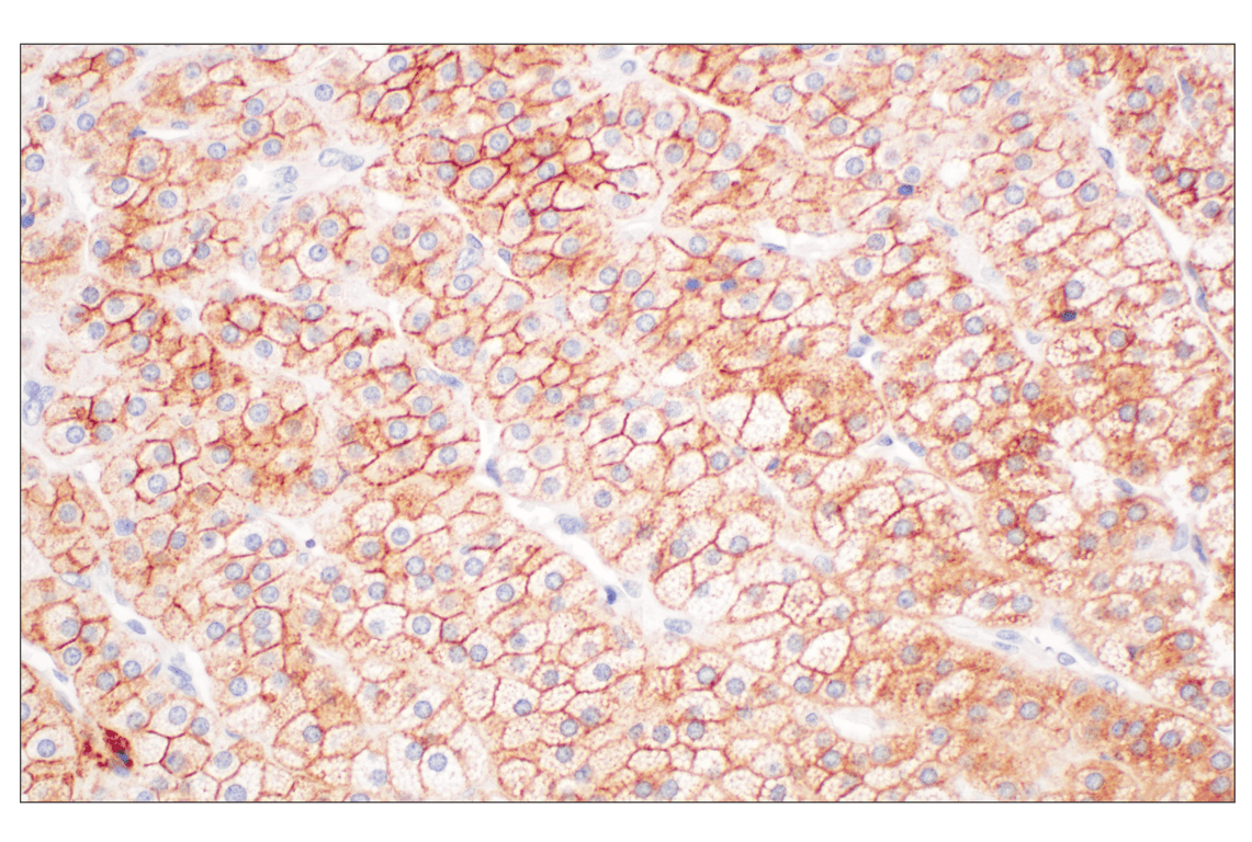 Immunohistochemistry Image 6: LY6E (F8Y1R) Rabbit Monoclonal Antibody