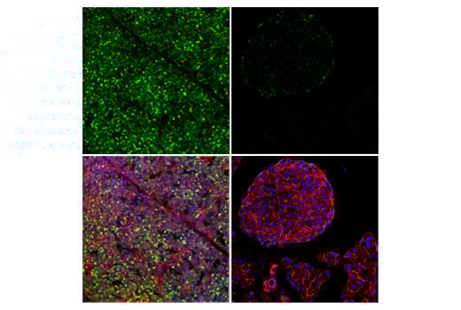 Immunofluorescence Image 1: Tox/Tox2 (E6G5O) Rabbit Monoclonal Antibody (BSA and Azide Free)
