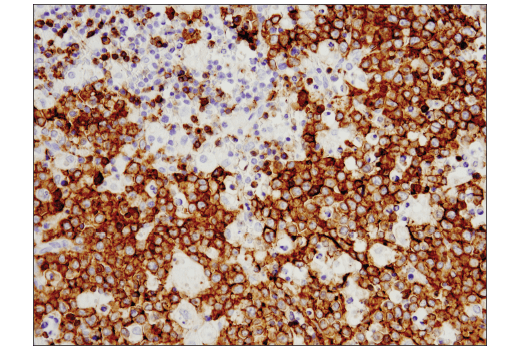 Immunohistochemistry Image 3: CD19 (Intracellular Domain) (D4V4B) Rabbit Monoclonal Antibody