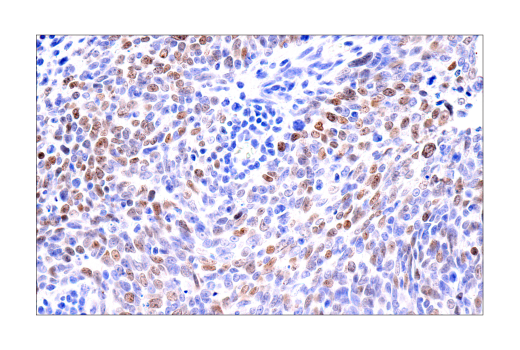 Immunohistochemistry Image 2: ATAD2 (E8Y7F) Rabbit Monoclonal Antibody
