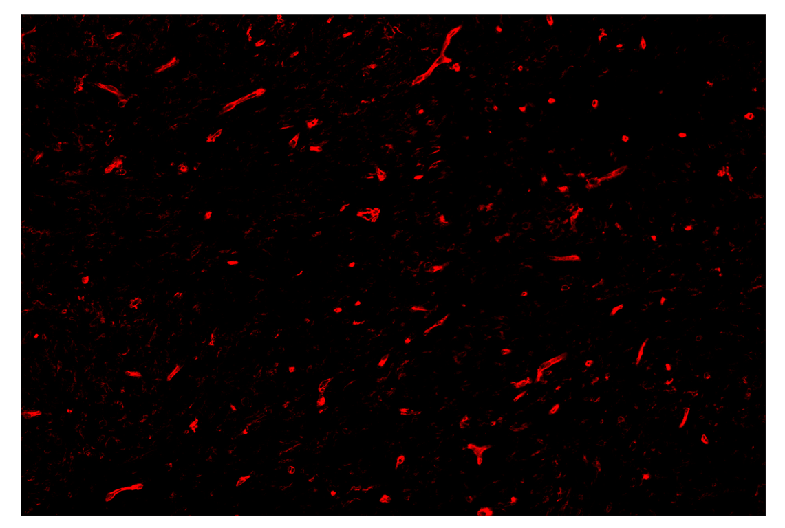 Immunohistochemistry Image 4: CD141/Thrombomodulin (E7Y9P) & CO-0088-594 SignalStar<sup>™</sup> Oligo-Antibody Pair