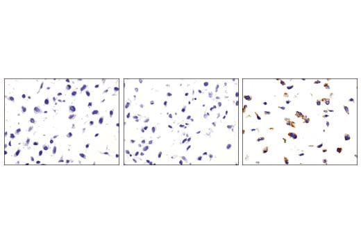 Immunohistochemistry Image 1: TrkC (C44H5) Rabbit Monoclonal Antibody