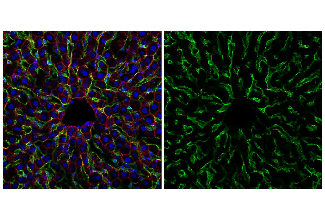 LYVE-1 (E3L3V) Rabbit mAb | Cell Signaling Technology