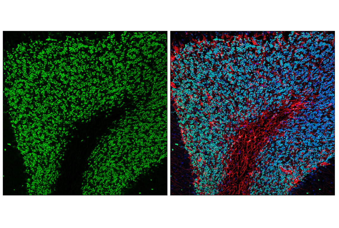 Immunofluorescence Image 2: Pax6 (D3A9V) Rabbit Monoclonal Antibody (BSA and Azide Free)