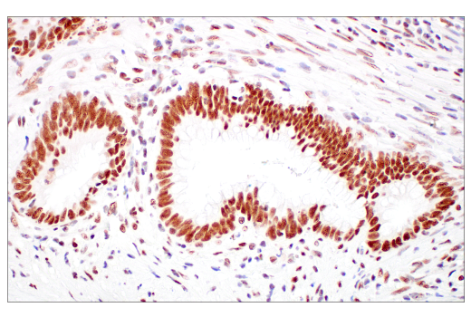 undefined Image 26: ATM Substrates Antibody Sampler Kit