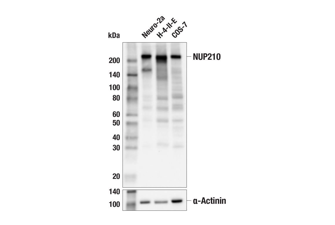 Western Blotting Image 2: NUP210 (E9A5G) Rabbit Monoclonal Antibody