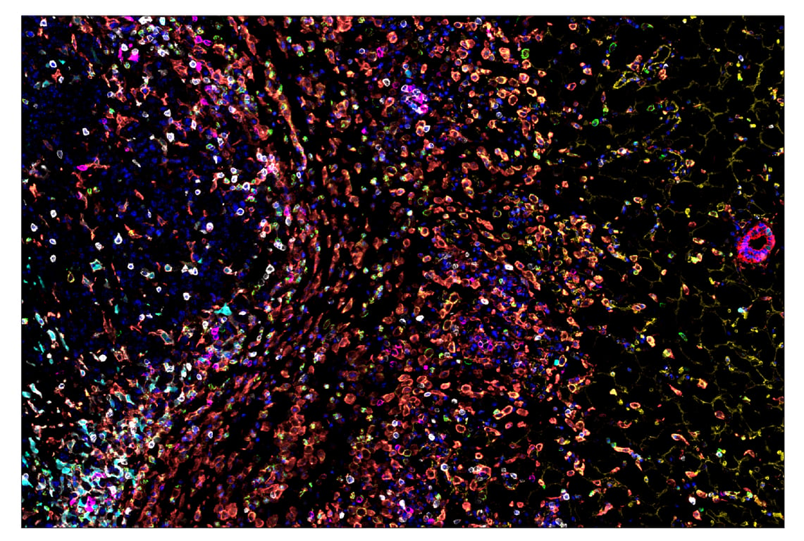 Immunohistochemistry Image 7: Pan-Keratin (Type I) (E6S1S) & CO-0072-750 SignalStar<sup>™</sup> Oligo-Antibody Pair