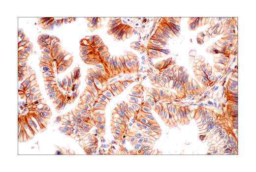Immunohistochemistry Image 7: CMTM6 (E6A8T) Rabbit Monoclonal Antibody