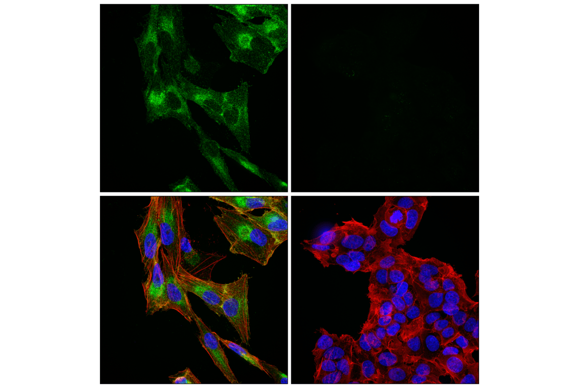 Immunofluorescence Image 1: ACSL4 (F6T3Z) Rabbit Monoclonal Antibody