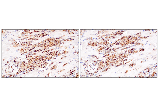 Immunohistochemistry Image 5: Cyclin D1 (E3P5S) Rabbit Monoclonal Antibody (BSA and Azide Free)