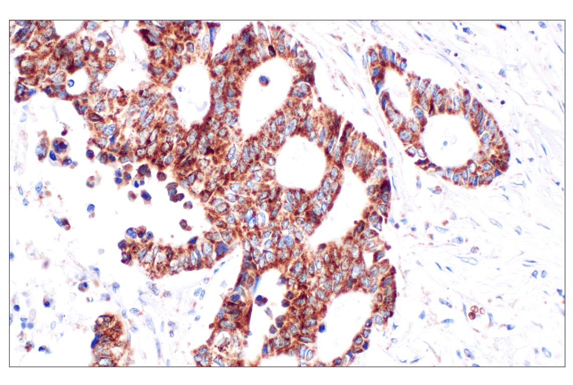undefined Image 28: Organelle Localization IF Antibody Sampler Kit