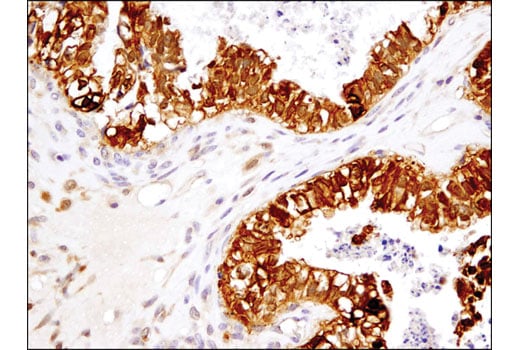 Immunohistochemistry Image 2: TRXR1 (D1T3D) Rabbit Monoclonal Antibody (BSA and Azide Free)
