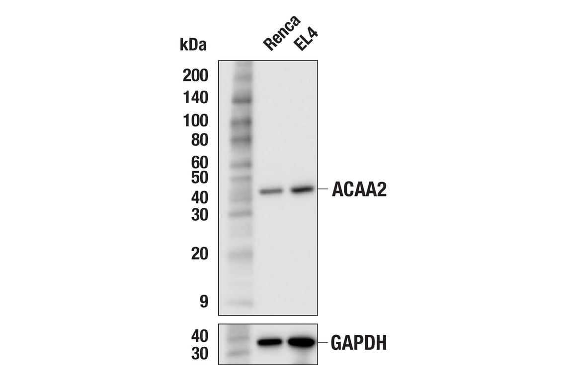 Western Blotting Image 2: ACAA2 (F4Y9U) Rabbit Monoclonal Antibody