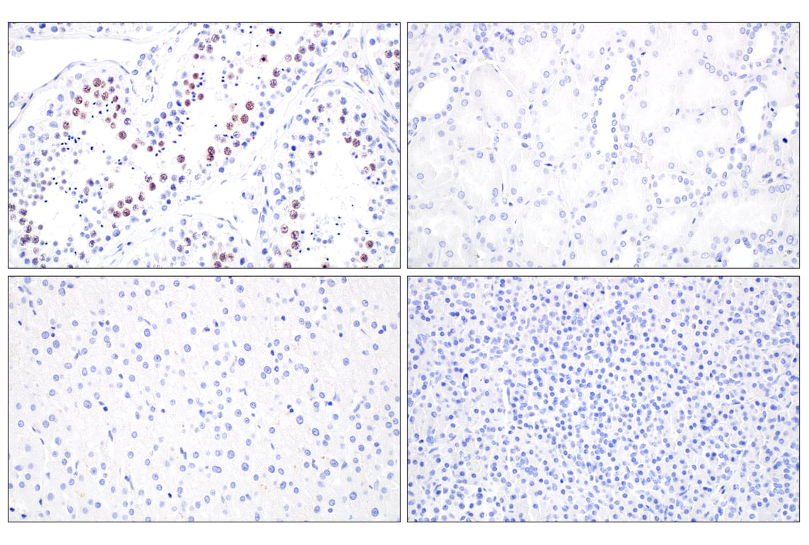 Immunohistochemistry Image 2: SGO2 (E9K4N) Rabbit Monoclonal Antibody
