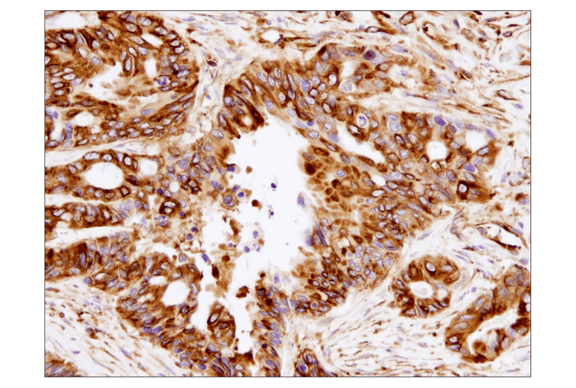 Immunohistochemistry Image 1: beta-Tubulin (D2N5G) Rabbit Monoclonal Antibody
