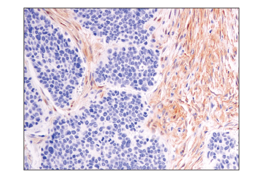 Immunohistochemistry Image 4: Notch2 (D76A6) Rabbit Monoclonal Antibody (BSA and Azide Free)