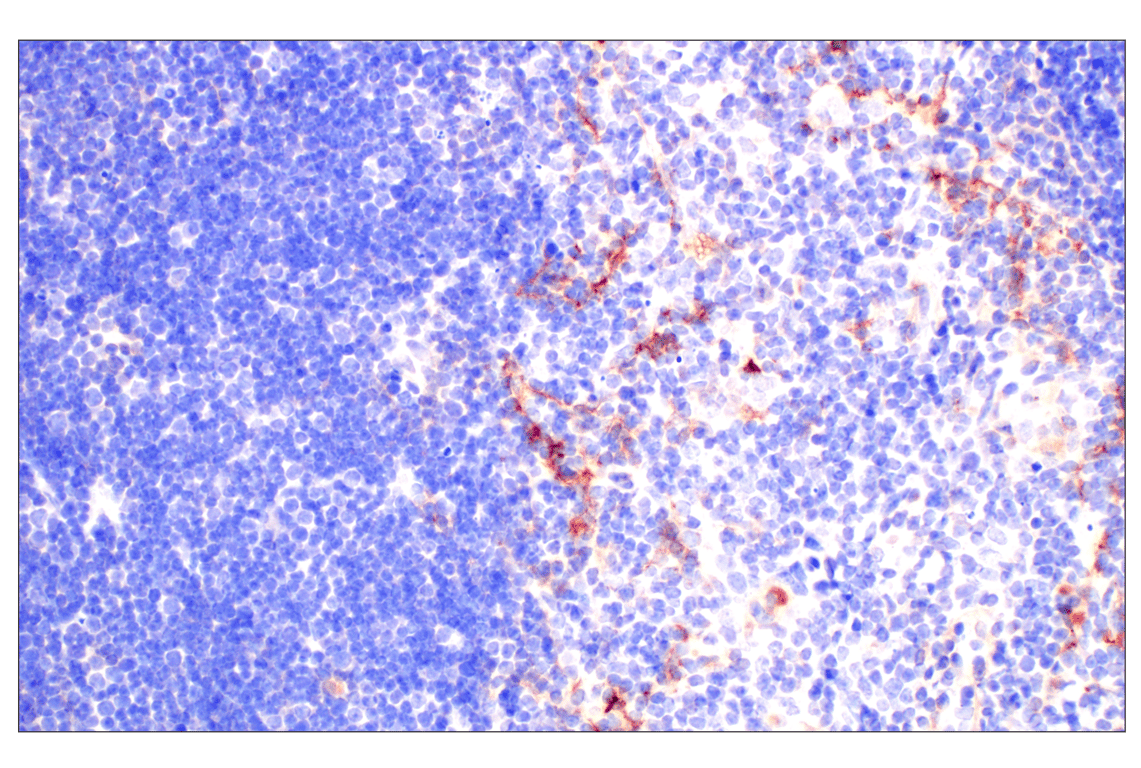 Immunohistochemistry Image 7: CD10/Neprilysin (F4P6H) Rabbit Monoclonal Antibody
