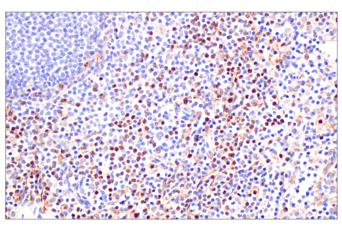 Immunohistochemistry Image 5: VISTA (D1L2G) Rabbit Monoclonal Antibody