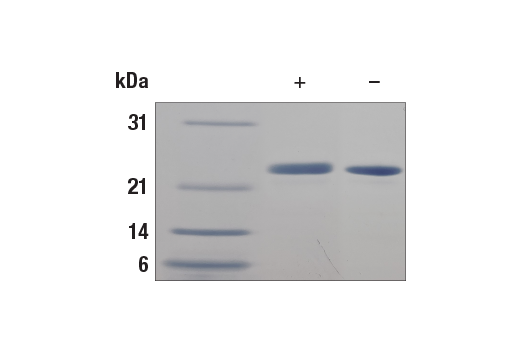 undefined Image 2: Human FGF-21 Recombinant Protein