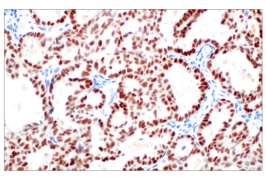 Immunohistochemistry Image 2: POU2F3 (E5N2D) Rabbit Monoclonal Antibody