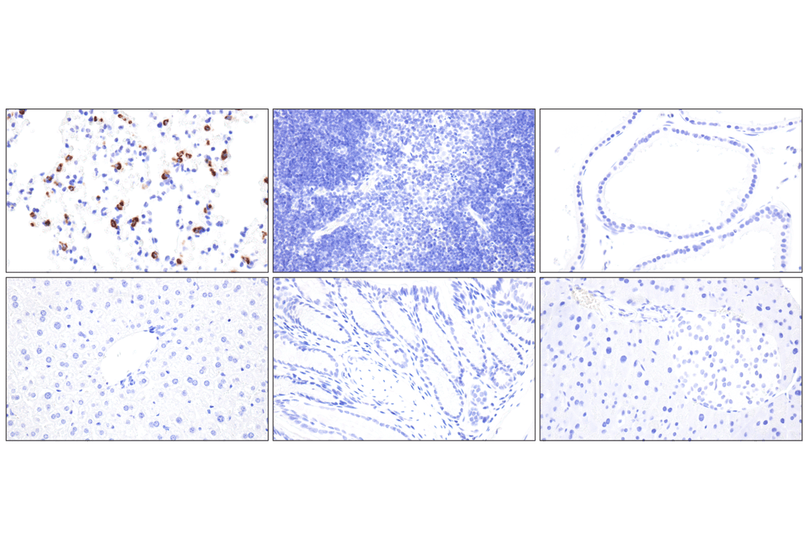 Immunohistochemistry Image 2: LAMP3/CD208 (E8T2T) Rabbit Monoclonal Antibody (BSA and Azide Free)
