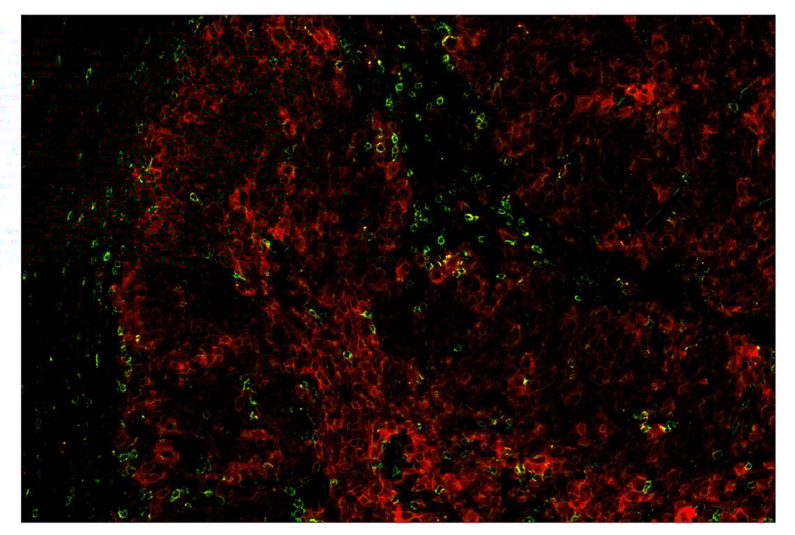 Immunohistochemistry Image 1: PD-1 (Intracellular Domain) (D4W2J) & CO-0008-488 SignalStar<sup>™</sup> Oligo-Antibody Pair