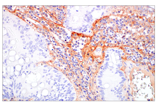 Immunohistochemistry Image 3: Decorin (E2N2C) XP<sup>®</sup> Rabbit mAb