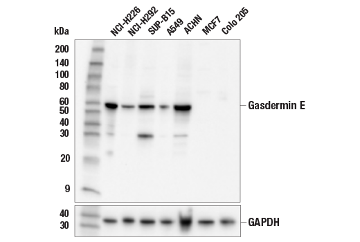 undefined Image 2: Gasdermin Family Antibody Sampler Kit