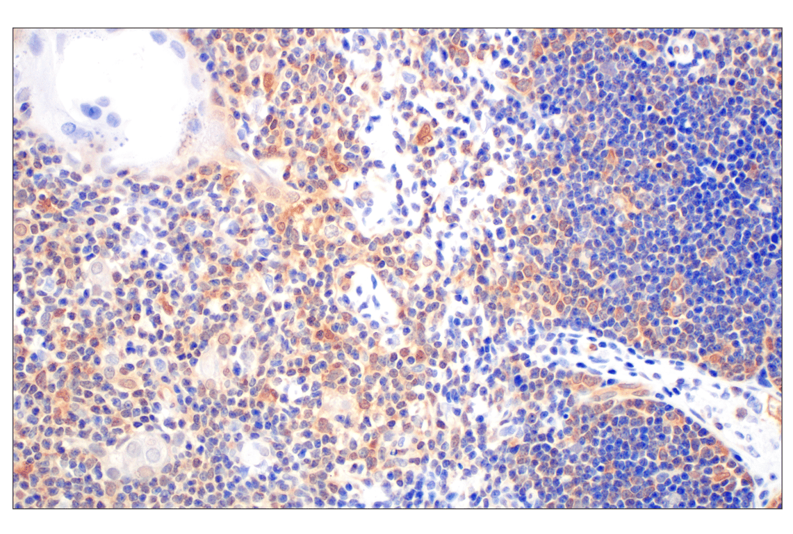 Immunohistochemistry Image 8: Galectin-8/LGALS8 (F9O3T) Rabbit Monoclonal Antibody