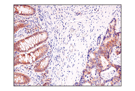 Immunohistochemistry Image 2: ASCT2 (D7C12) Rabbit Monoclonal Antibody