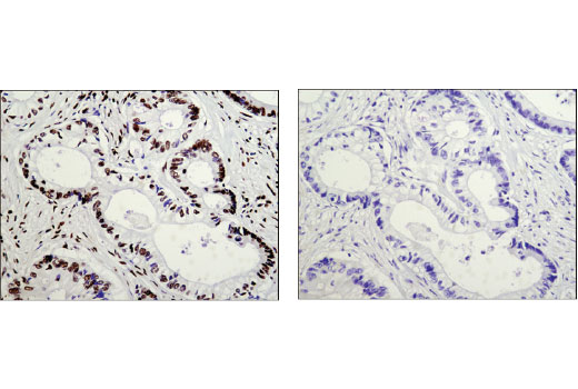 Immunohistochemistry Image 1: AUF1/hnRNP D (D6O4F) Rabbit Monoclonal Antibody