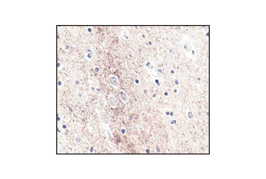undefined Image 13: Alzheimer's Disease Antibody Sampler Kit
