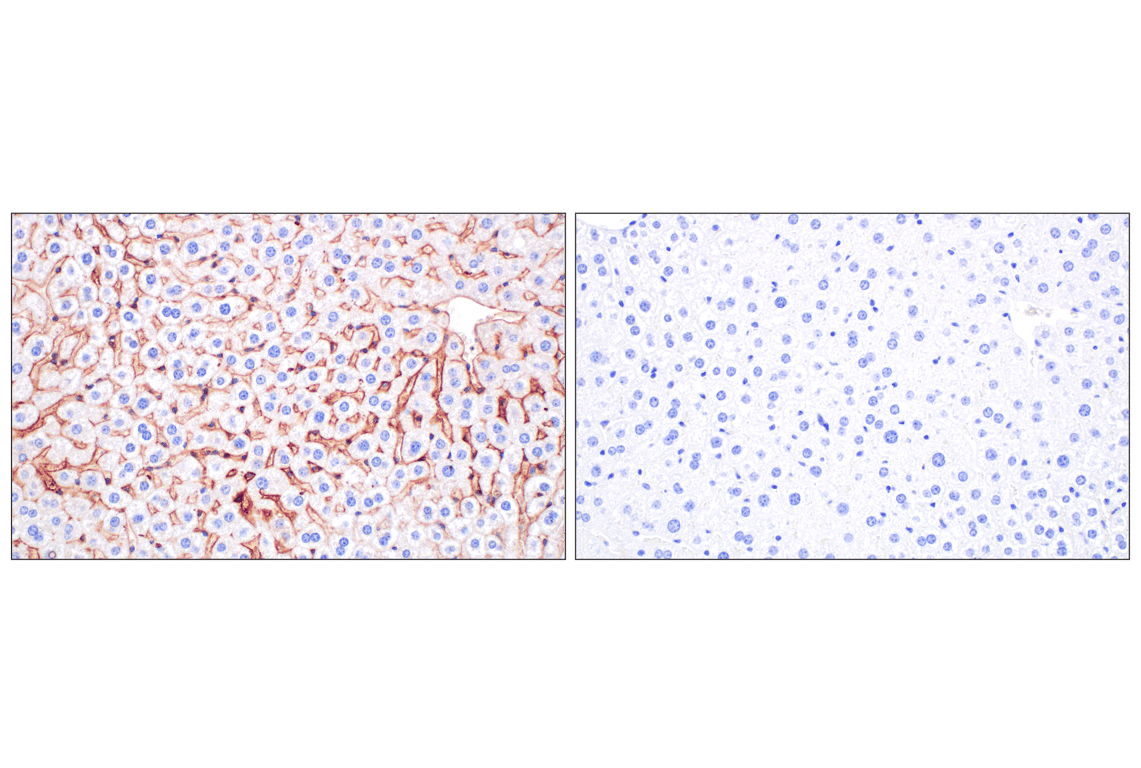 Immunohistochemistry Image 7: PNPLA3 (E7N6O) Rabbit Monoclonal Antibody (BSA and Azide Free)