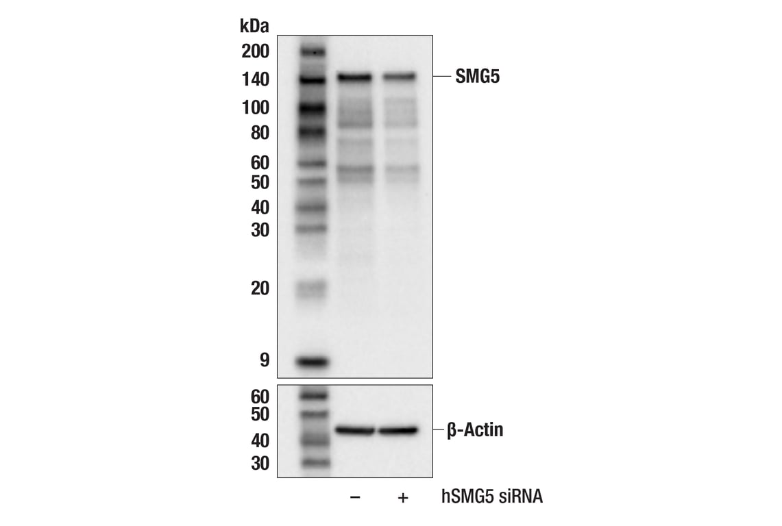 Western Blotting Image 2: SMG5 (F9P6O) Rabbit Monoclonal Antibody