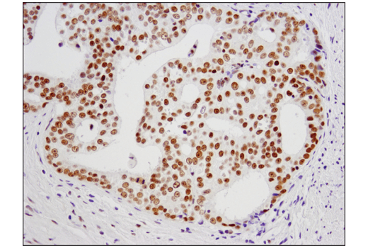 Immunohistochemistry Image 5: ESET (D4M8R) XP<sup>®</sup> Rabbit mAb